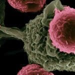 New targets found for diagnosing, treating aggressive cancers