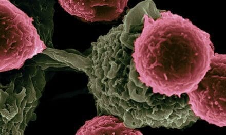 New targets found for diagnosing, treating aggressive cancers